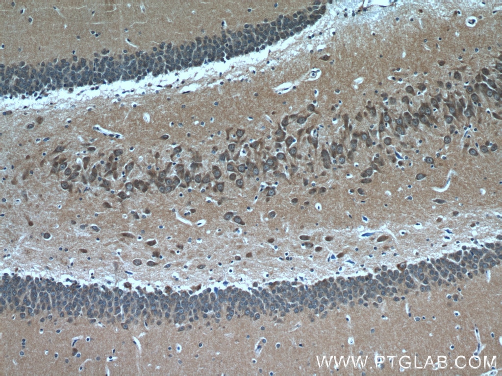 IHC staining of rat brain using 20747-1-AP