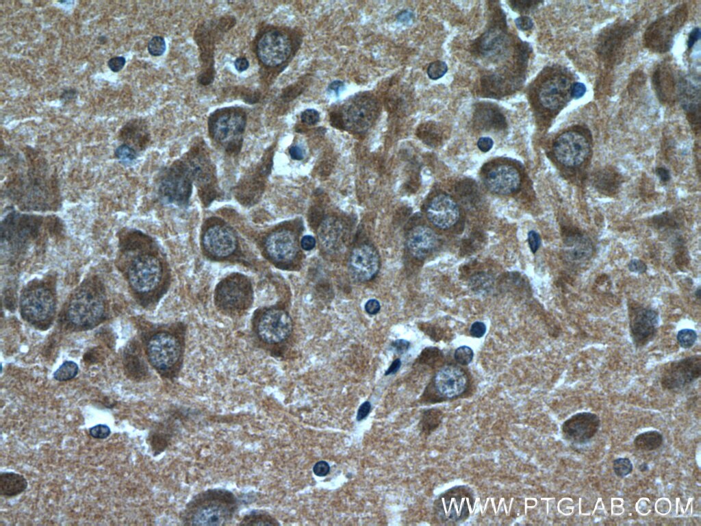 Immunohistochemistry (IHC) staining of rat brain tissue using CHAT Polyclonal antibody (20747-1-AP)