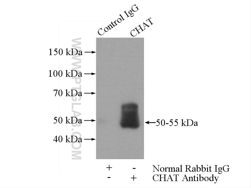 Immunoprecipitation (IP) experiment of rat brain tissue using CHAT Polyclonal antibody (20747-1-AP)