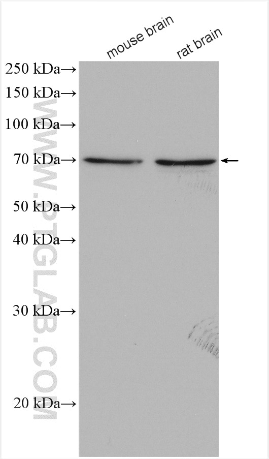 Western Blot (WB) analysis of various lysates using CHAT Polyclonal antibody (20747-1-AP)