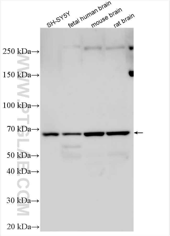 WB analysis using 20747-1-AP Western Blot (WB) analysis of various lysates using CHAT Polyclonal antibody (20747-1-AP)