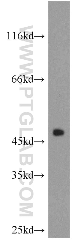 Western Blot (WB) analysis of mouse placenta tissue using CHAT Polyclonal antibody (20747-1-AP)