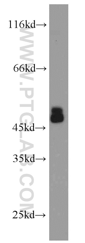 Western Blot (WB) analysis of human placenta tissue using CHAT Polyclonal antibody (20747-1-AP)