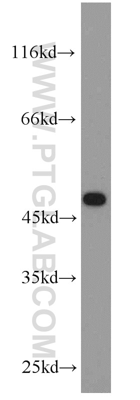 Western Blot (WB) analysis of Jurkat cells using CHAT Polyclonal antibody (20747-1-AP)
