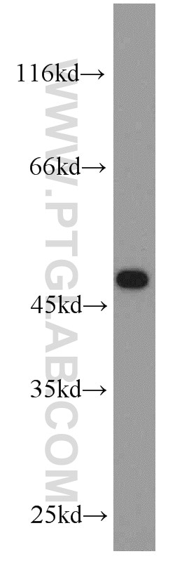 WB analysis of Jurkat using 20747-1-AP