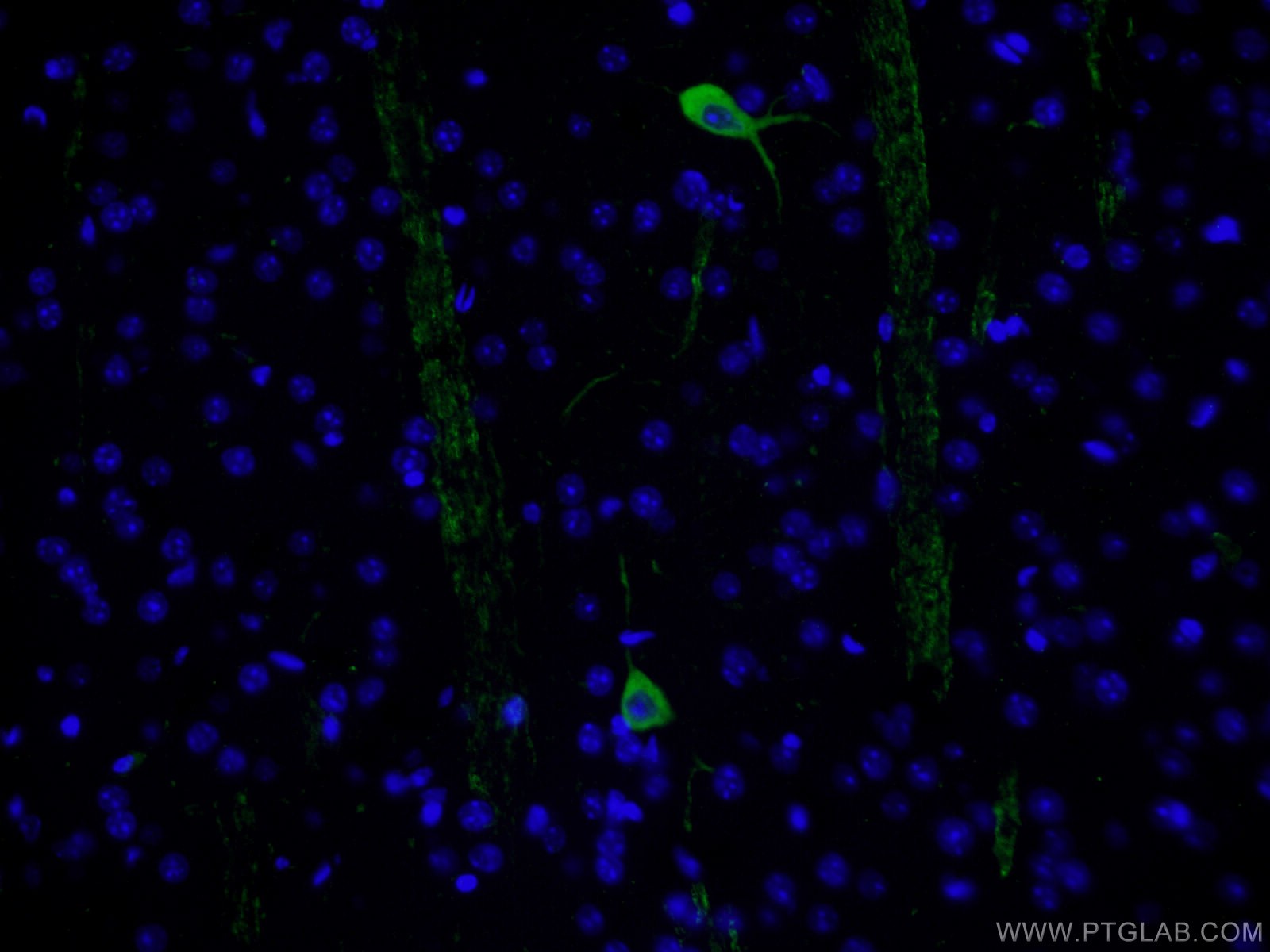 Immunofluorescence (IF) / fluorescent staining of mouse brain tissue using CHAT Polyclonal antibody (24418-1-AP)