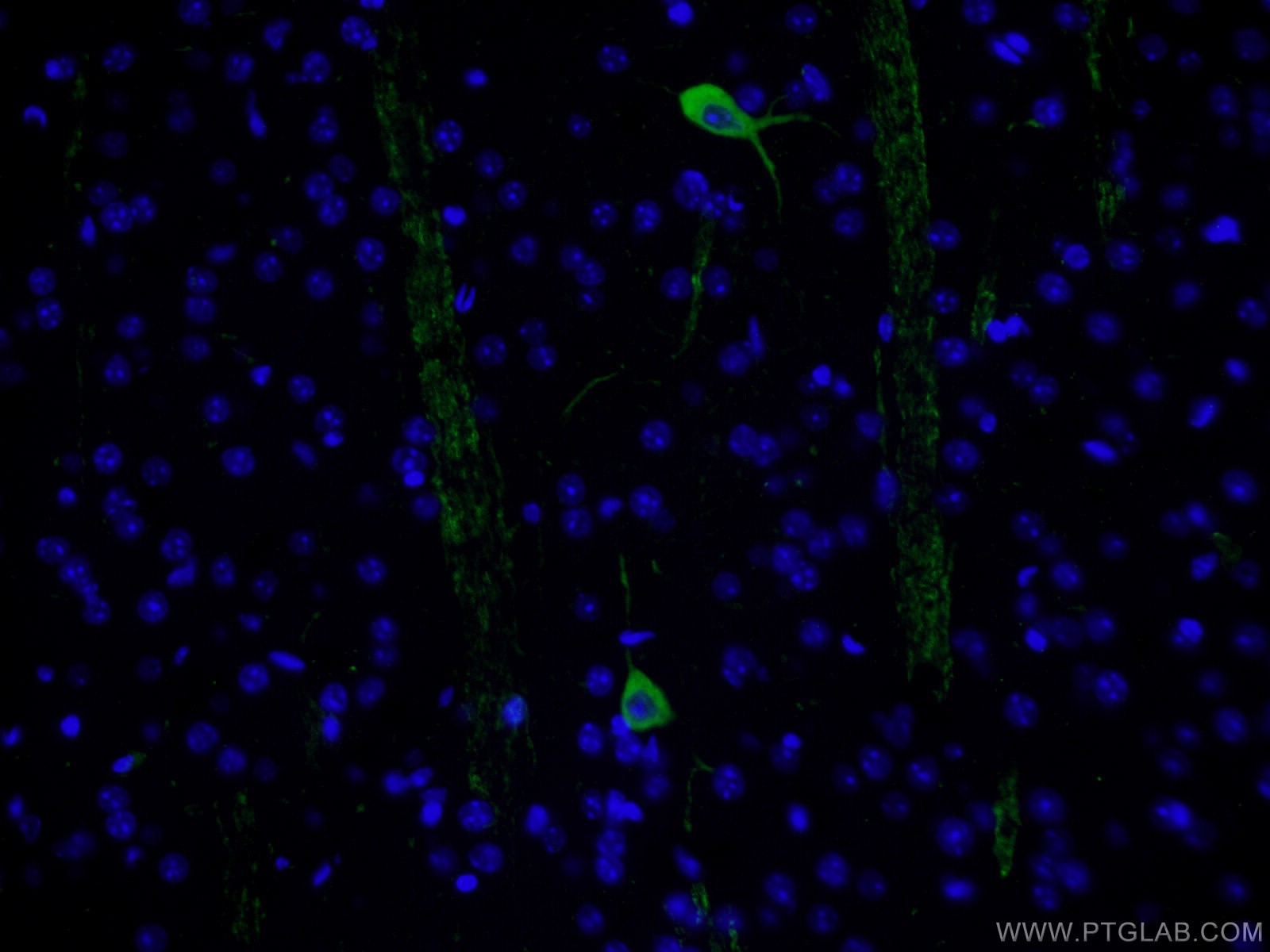 Immunofluorescence (IF) / fluorescent staining of mouse brain tissue using CHAT Polyclonal antibody (24418-1-AP)