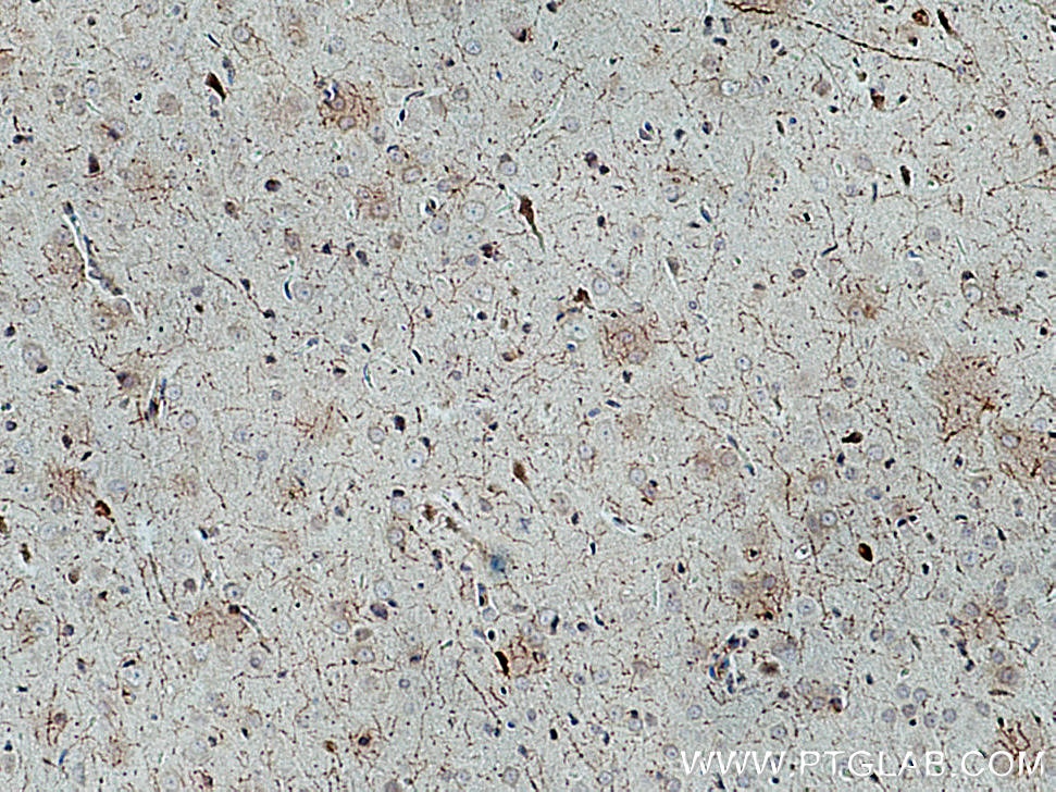 Immunohistochemistry (IHC) staining of rat brain tissue using CHAT Polyclonal antibody (24418-1-AP)