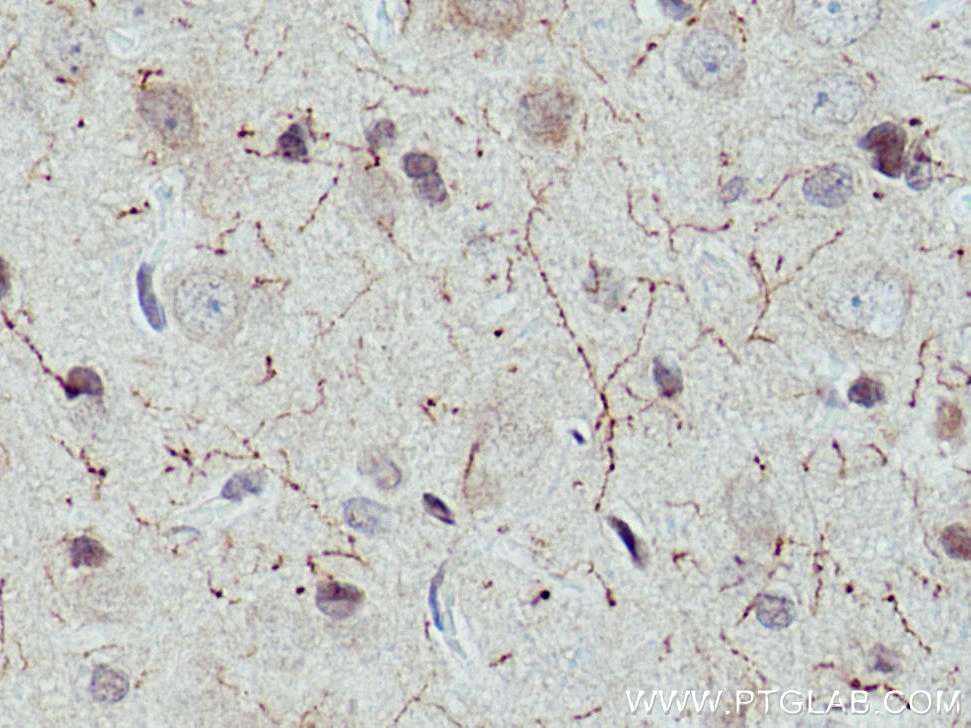 Immunohistochemistry (IHC) staining of rat brain tissue using CHAT Polyclonal antibody (24418-1-AP)