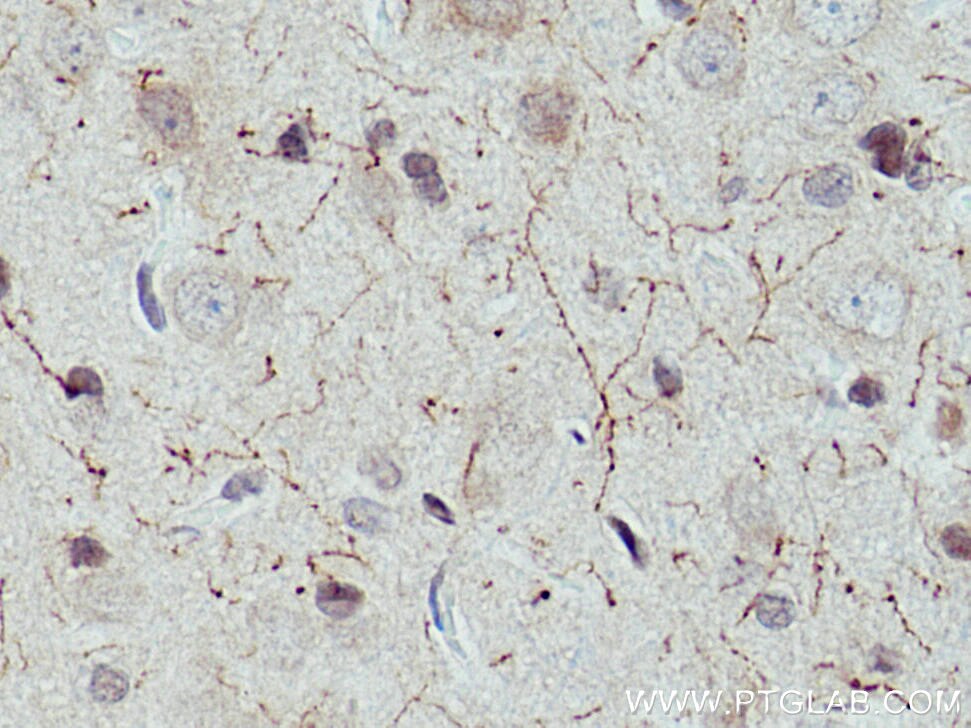 IHC staining of rat brain using 24418-1-AP