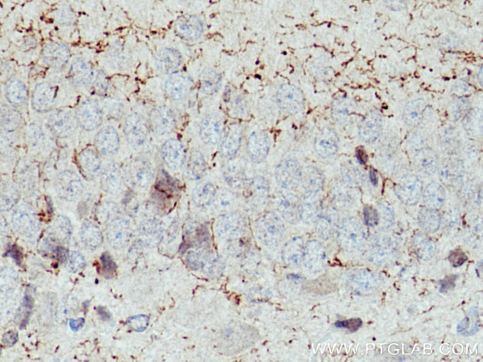 Immunohistochemistry (IHC) staining of rat brain tissue using CHAT Polyclonal antibody (24418-1-AP)