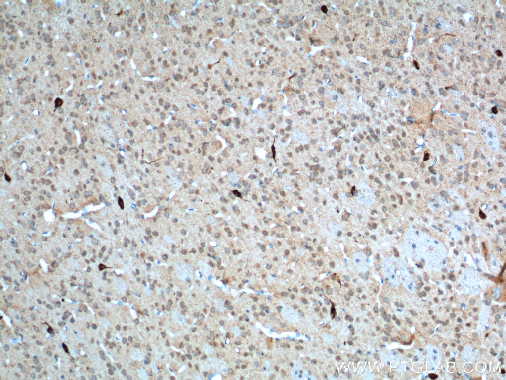 Immunohistochemistry (IHC) staining of mouse brain tissue using CHAT Polyclonal antibody (24418-1-AP)