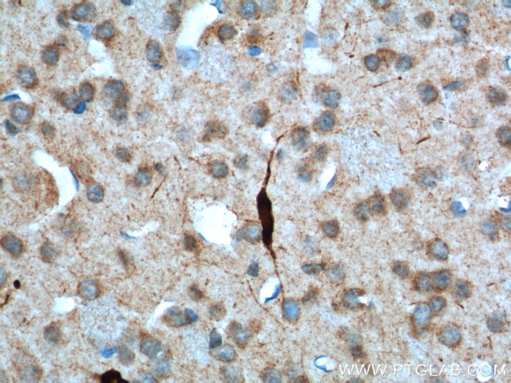 Immunohistochemistry (IHC) staining of mouse brain tissue using CHAT Polyclonal antibody (24418-1-AP)