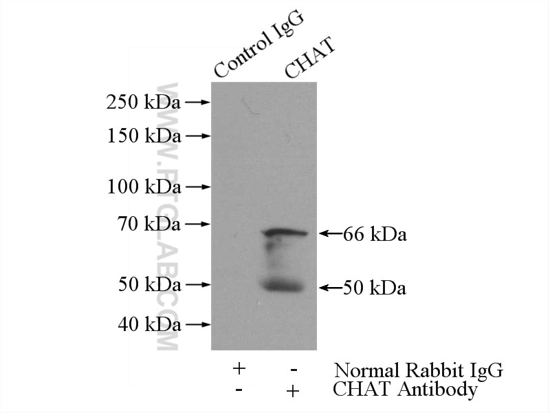 Immunoprecipitation (IP) experiment of rat brain tissue using CHAT Polyclonal antibody (24418-1-AP)