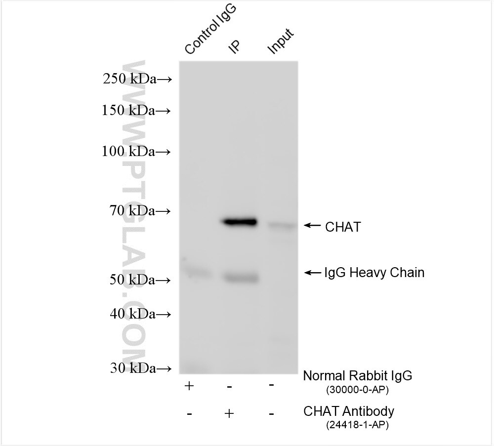 Immunoprecipitation (IP) experiment of rat brain tissue using CHAT Polyclonal antibody (24418-1-AP)