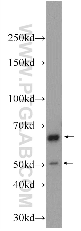 Western Blot (WB) analysis of rat brain tissue using CHAT Polyclonal antibody (24418-1-AP)