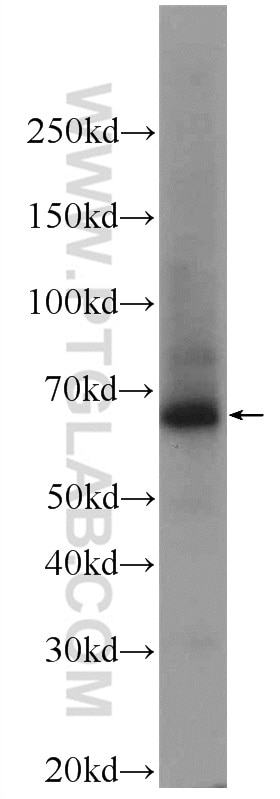 Western Blot (WB) analysis of human placenta tissue using CHAT Polyclonal antibody (24418-1-AP)