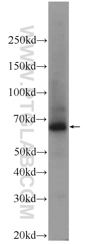 WB analysis of human placenta using 24418-1-AP