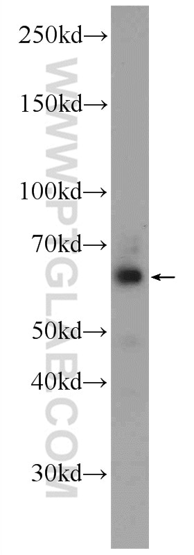 Western Blot (WB) analysis of mouse brain tissue using CHAT Polyclonal antibody (24418-1-AP)