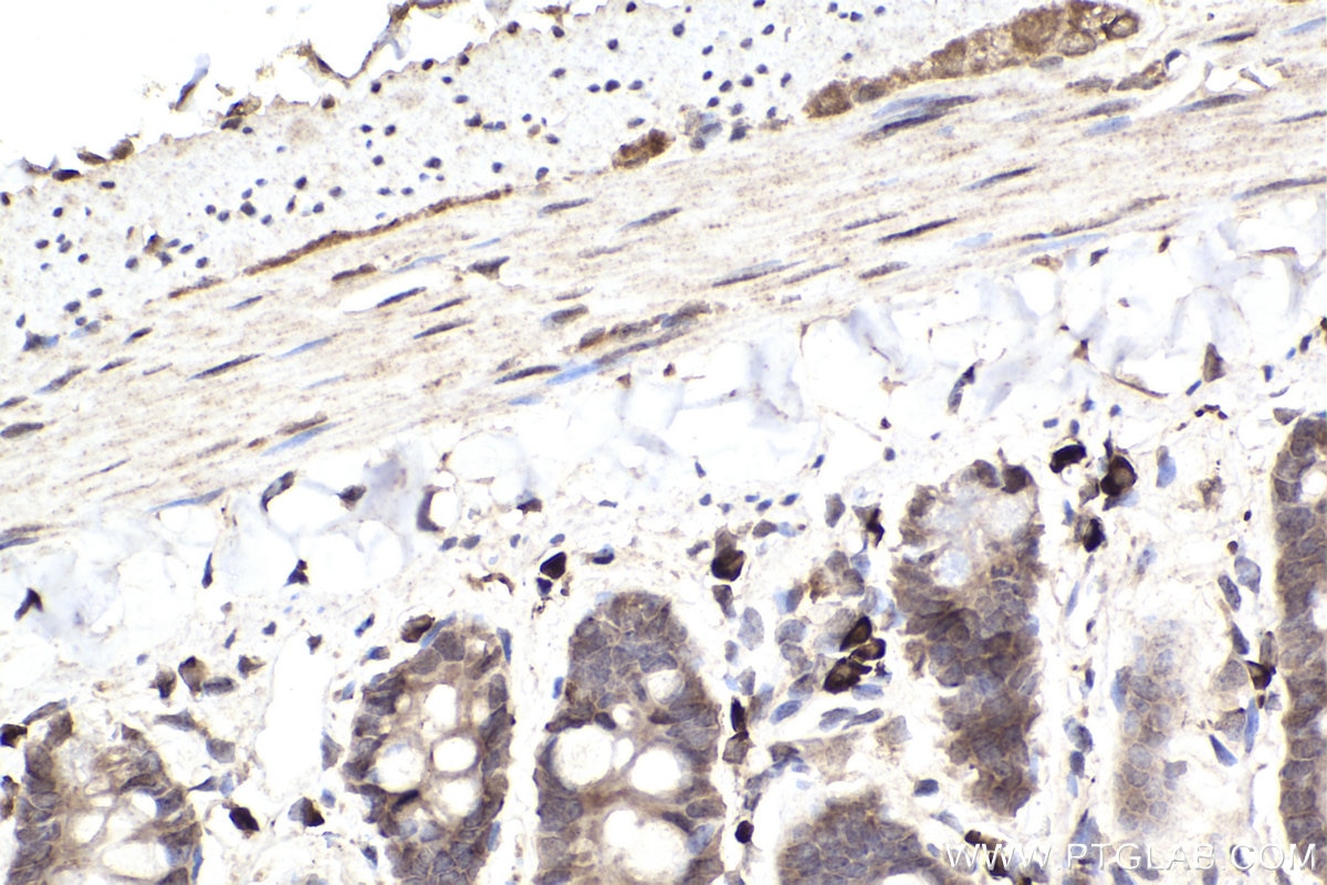 Immunohistochemistry (IHC) staining of rat small intestine tissue using CHAT Monoclonal antibody (66816-1-Ig)