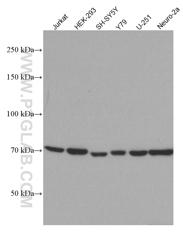 Western Blot (WB) analysis of various lysates using CHAT Monoclonal antibody (66816-1-Ig)