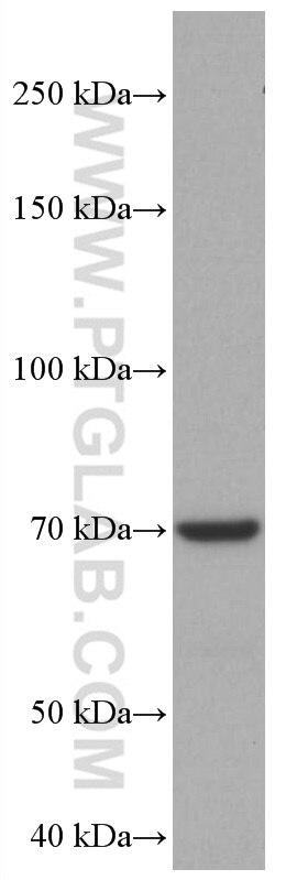 Western Blot (WB) analysis of PC-12 cells using CHAT Monoclonal antibody (66816-1-Ig)