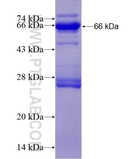 CHAT fusion protein Ag19550 SDS-PAGE