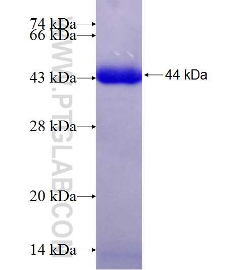 CHAT fusion protein Ag19602 SDS-PAGE