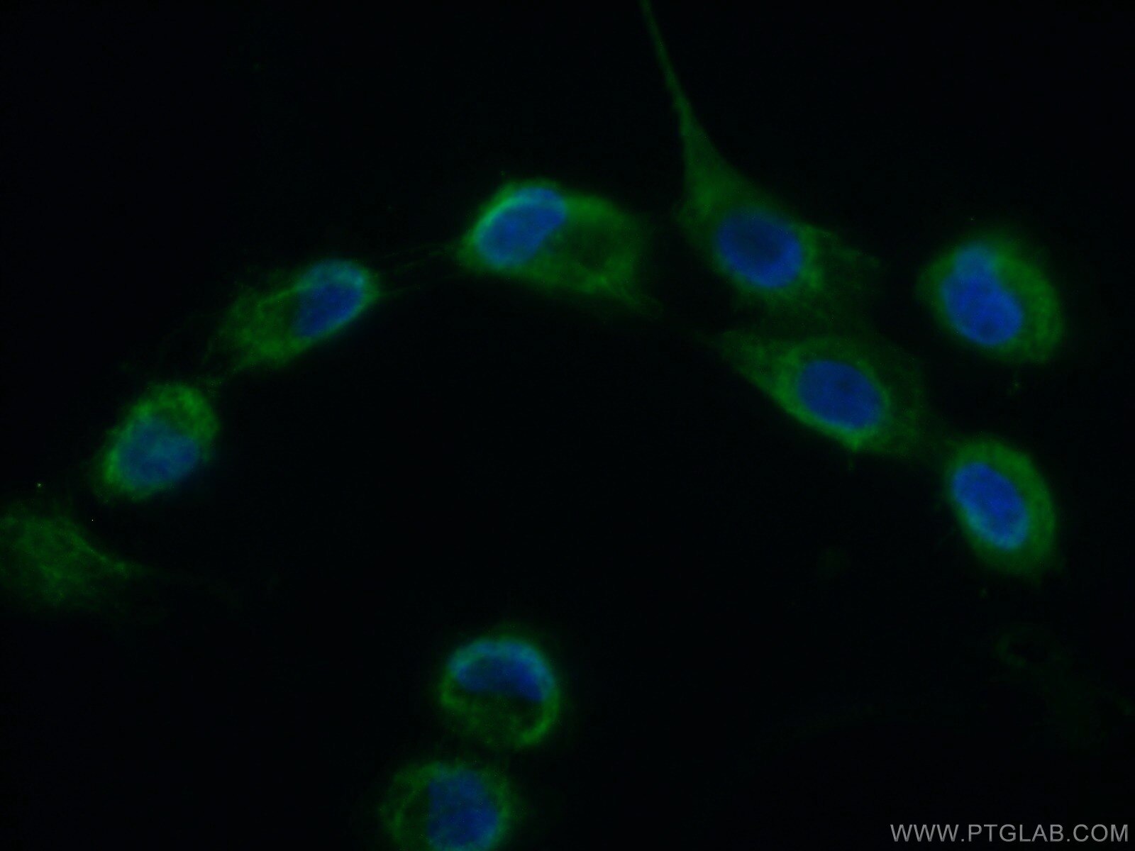 Immunofluorescence (IF) / fluorescent staining of A431 cells using CHCHD1 Polyclonal antibody (11728-1-AP)