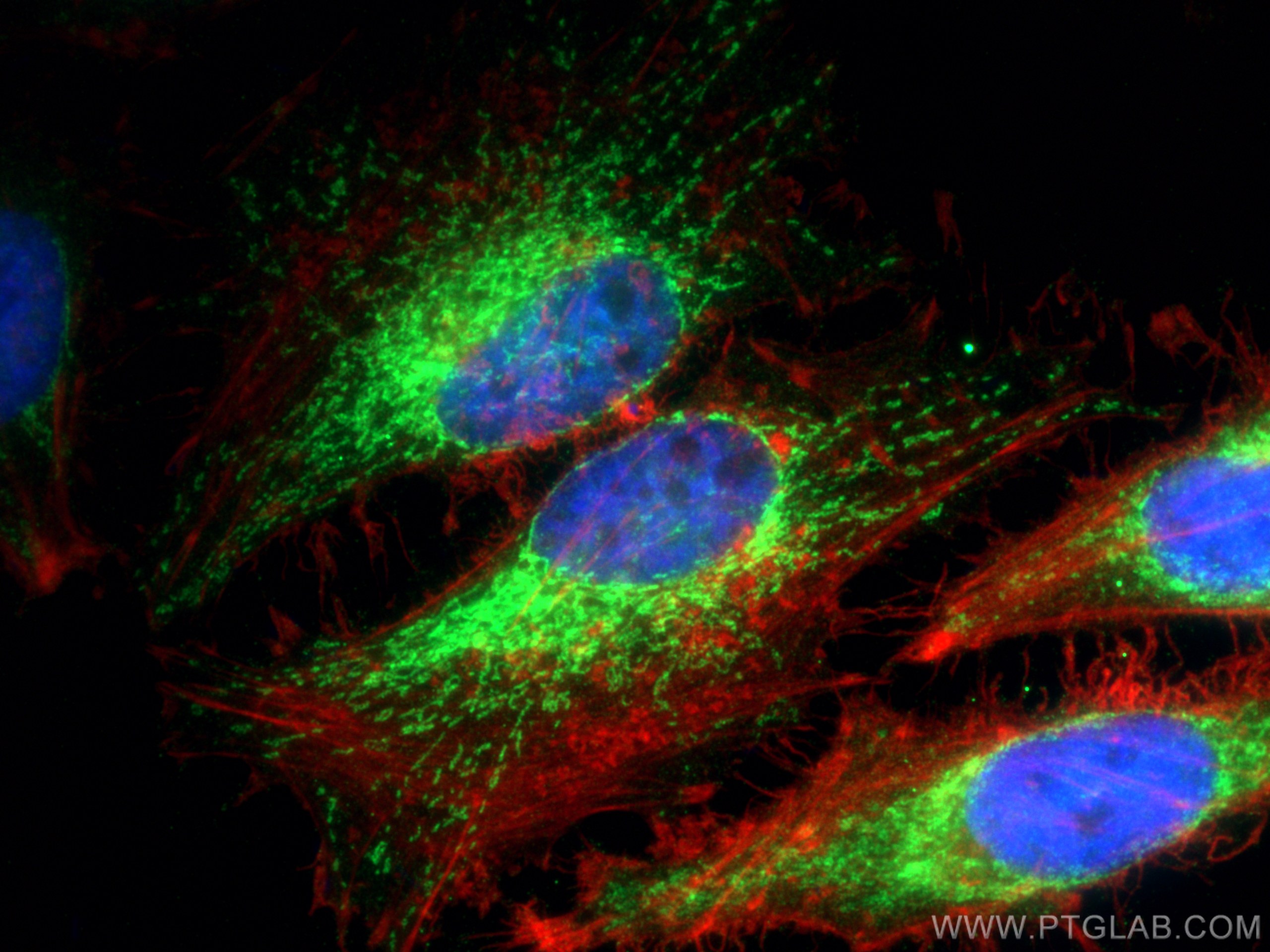Immunofluorescence (IF) / fluorescent staining of HeLa cells using CHCHD10 Polyclonal antibody (25671-1-AP)