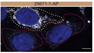 Immunofluorescence (IF) / fluorescent staining of HAP1 cells using CHCHD10 Polyclonal antibody (25671-1-AP)