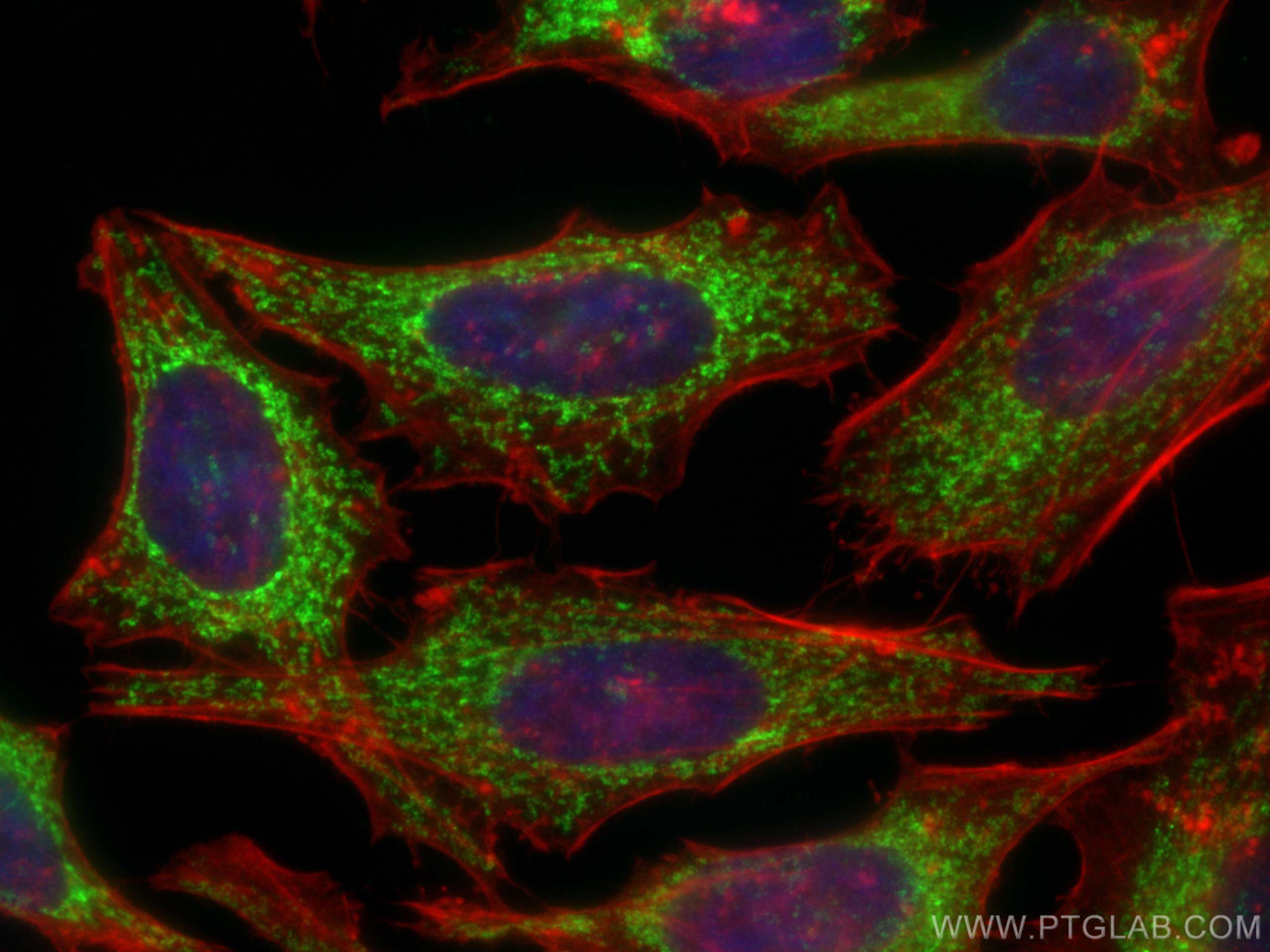 Immunofluorescence (IF) / fluorescent staining of HeLa cells using CHCHD10 Polyclonal antibody (25671-1-AP)