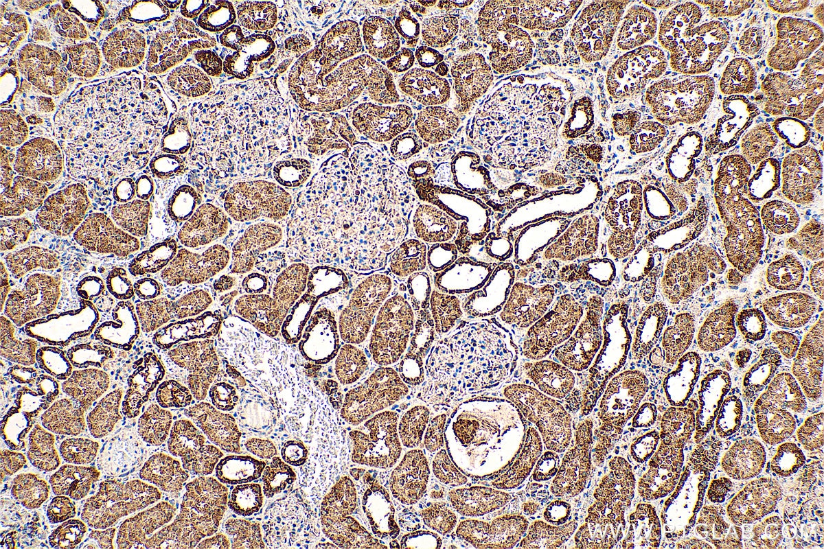 Immunohistochemistry (IHC) staining of human kidney tissue using CHCHD10 Polyclonal antibody (25671-1-AP)