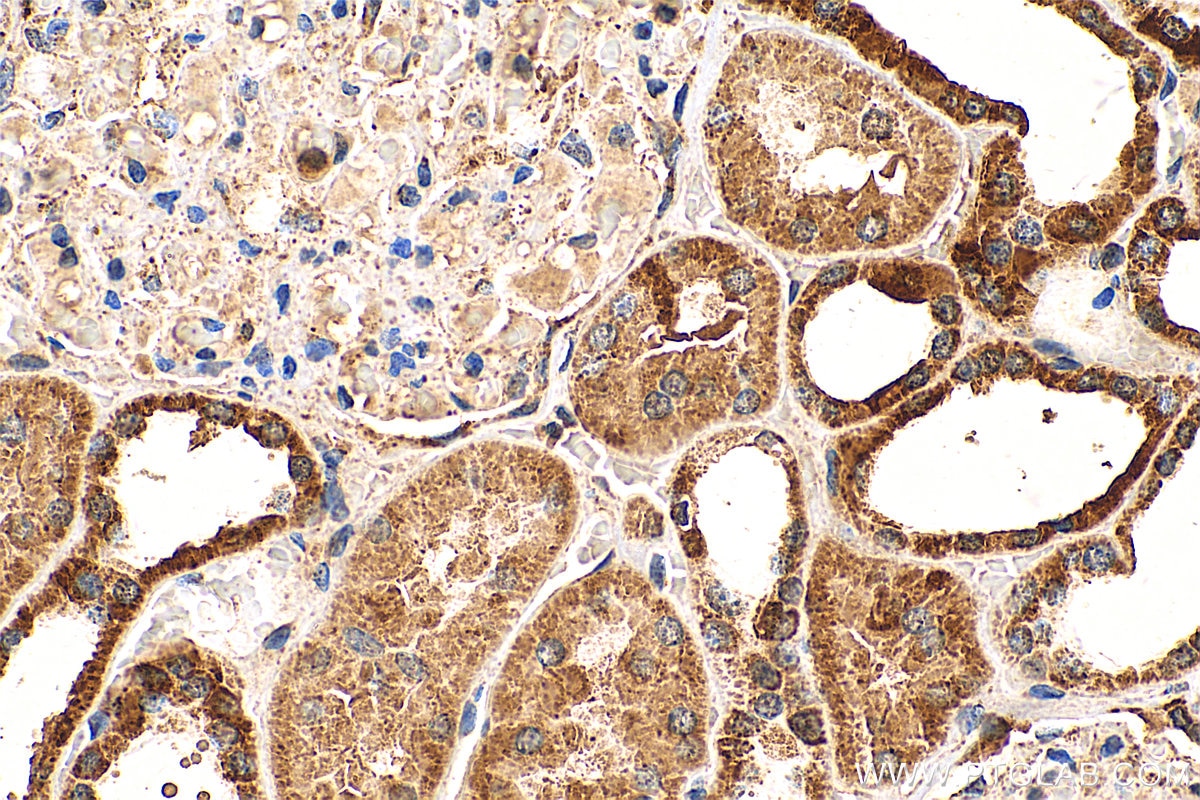 Immunohistochemistry (IHC) staining of human kidney tissue using CHCHD10 Polyclonal antibody (25671-1-AP)