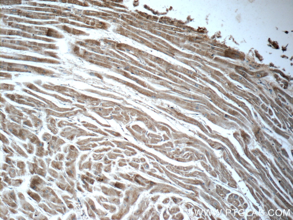 Immunohistochemistry (IHC) staining of human heart tissue using CHCHD10 Polyclonal antibody (25671-1-AP)
