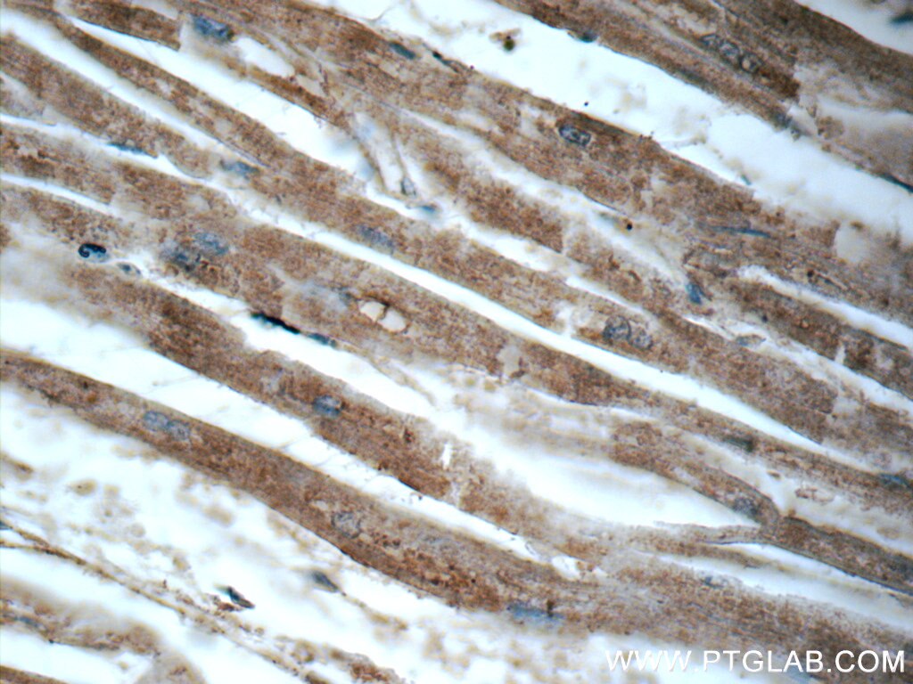 Immunohistochemistry (IHC) staining of human heart tissue using CHCHD10 Polyclonal antibody (25671-1-AP)