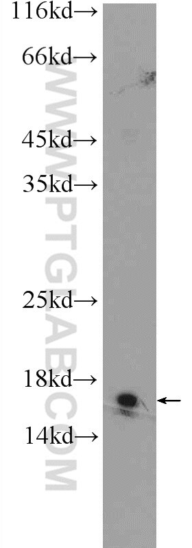 Western Blot (WB) analysis of mouse brain tissue using CHCHD10 Polyclonal antibody (25671-1-AP)