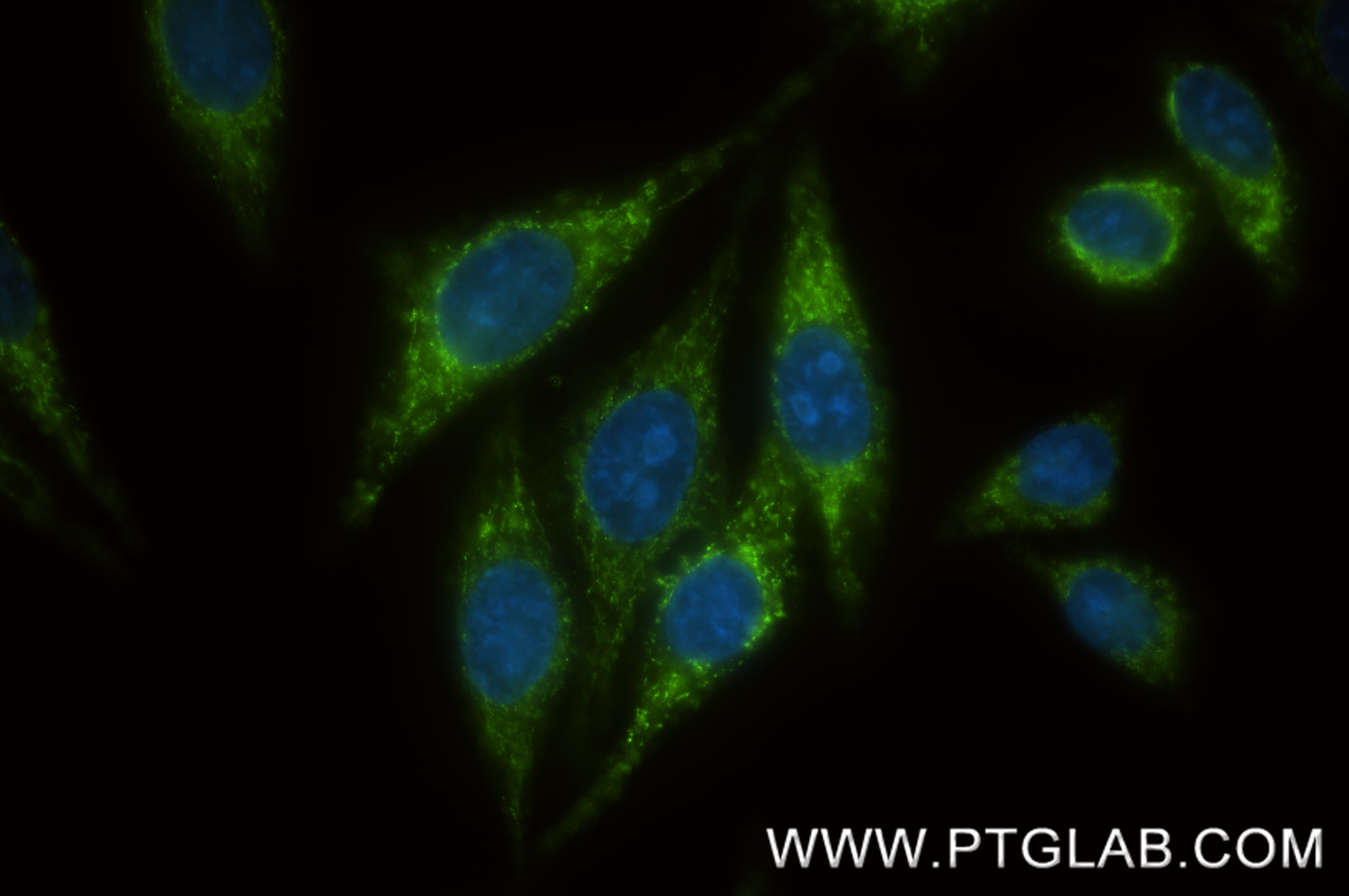 IF Staining of HepG2 using 87812-2-RR (same clone as 87812-2-PBS) Immunofluorescence (IF) / fluorescent staining of HepG2 cells using CHCHD10 Recombinant monoclonal antibody (87812-2-RR)
