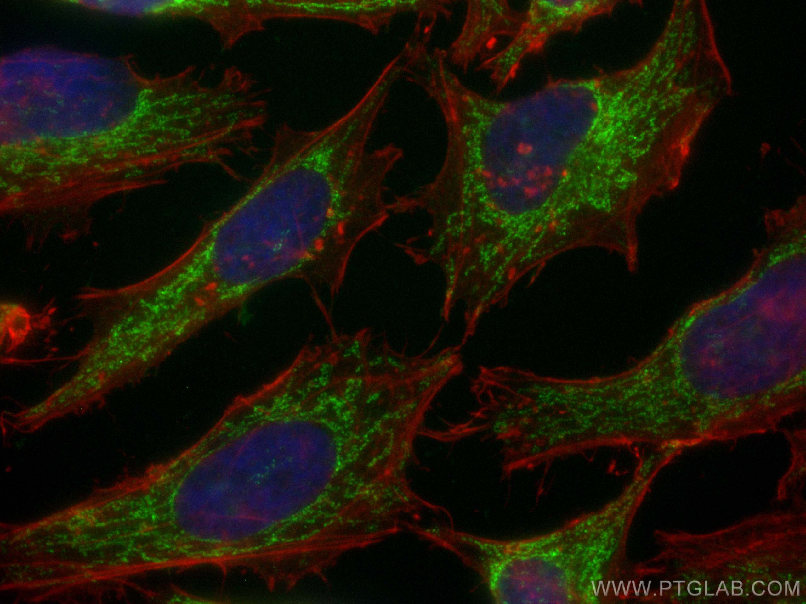 Immunofluorescence (IF) / fluorescent staining of HeLa cells using CoraLite® Plus 488-conjugated CHCHD10 Polyclonal a (CL488-25671)