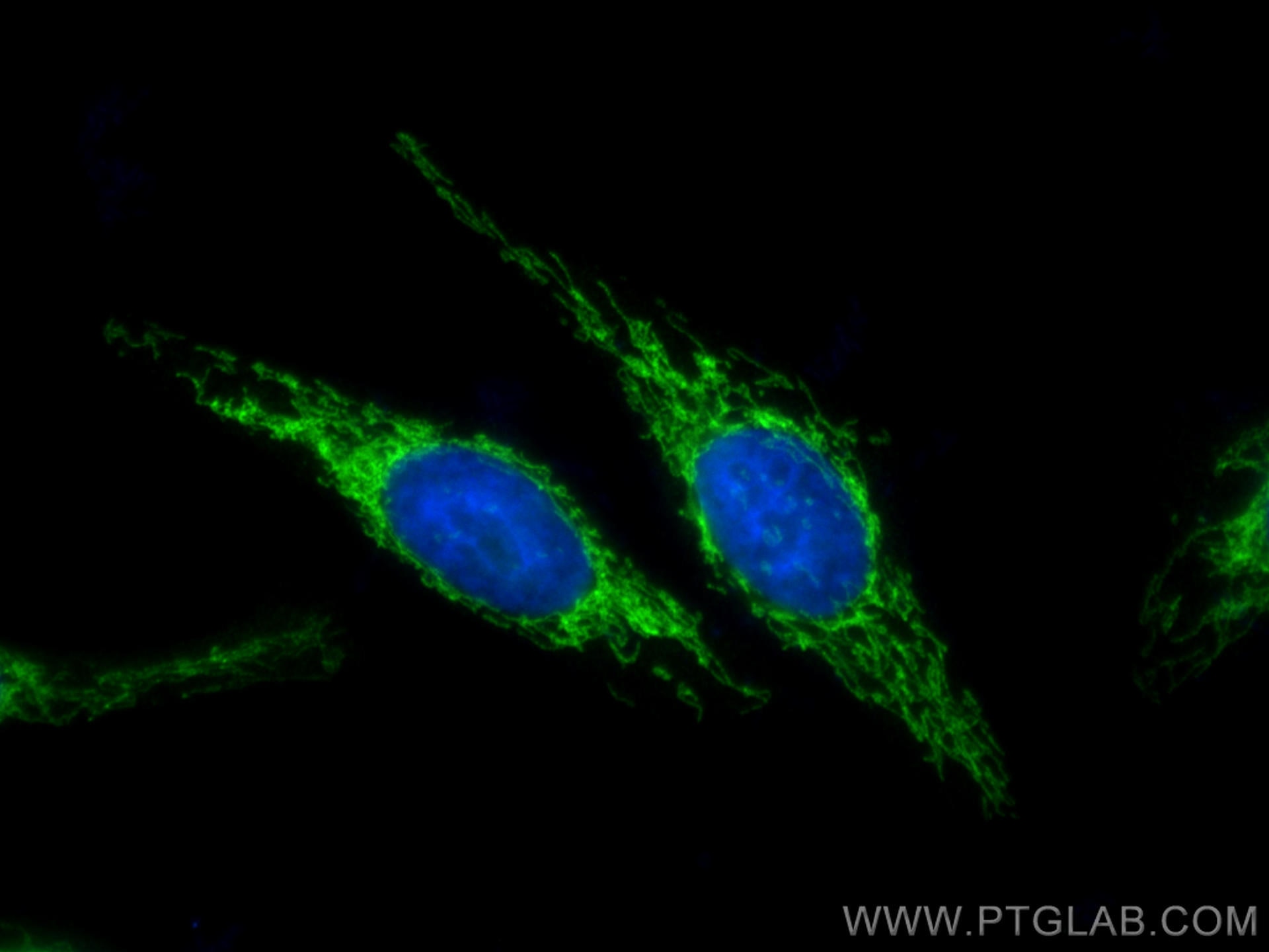 IF Staining of HepG2 using 19424-1-AP