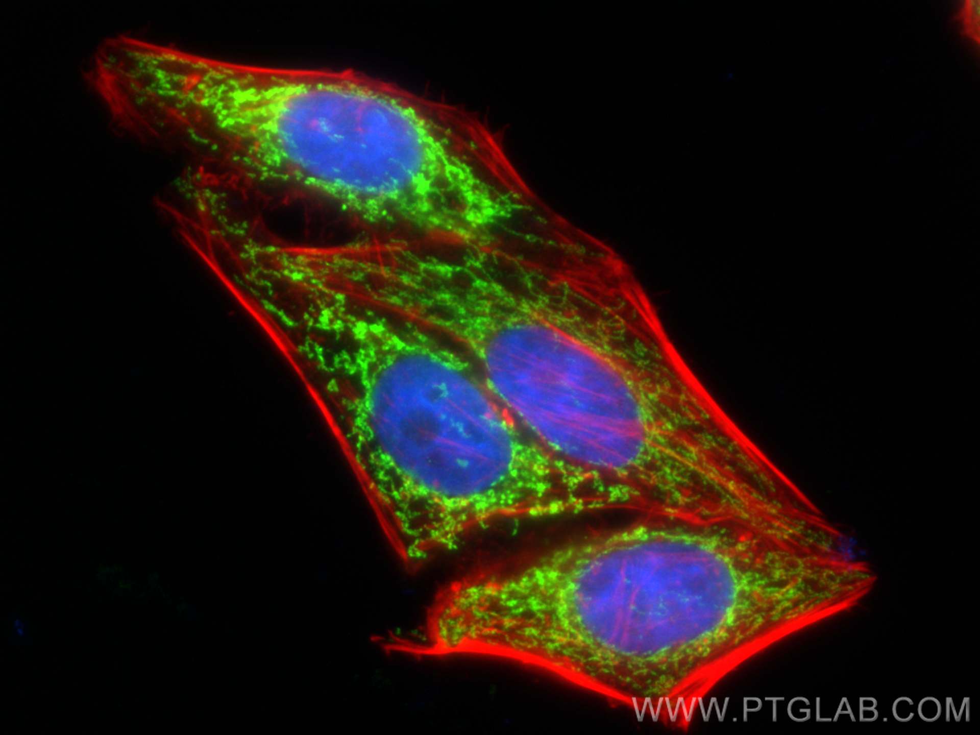 Immunofluorescence (IF) / fluorescent staining of HepG2 cells using CHCHD2 Polyclonal antibody (19424-1-AP)