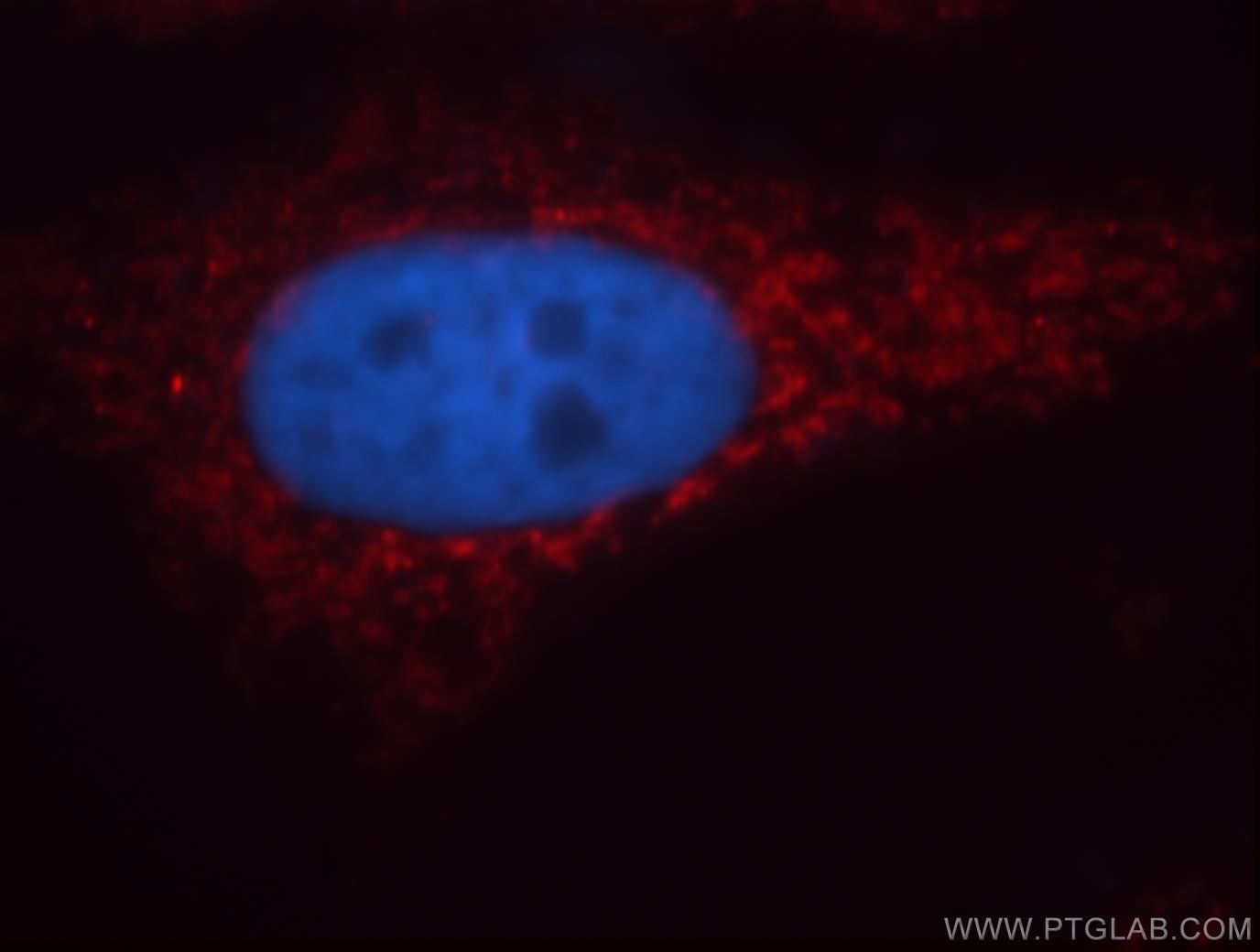 Immunofluorescence (IF) / fluorescent staining of HepG2 cells using CHCHD2 Polyclonal antibody (19424-1-AP)