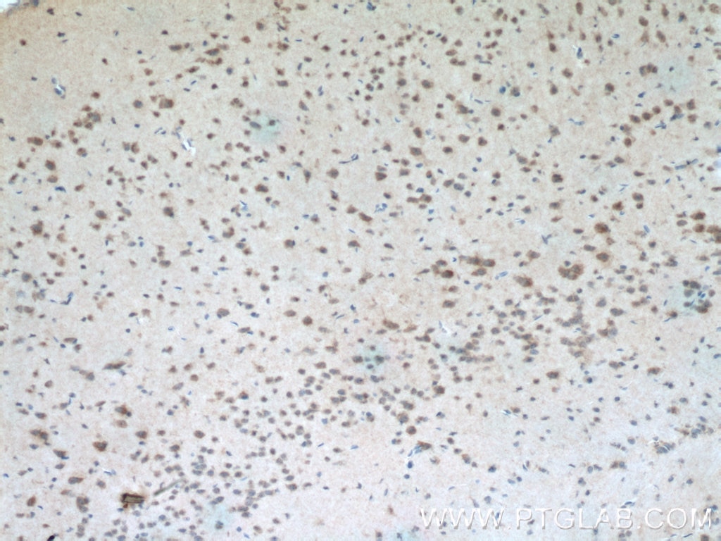 Immunohistochemistry (IHC) staining of mouse brain tissue using CHCHD2 Polyclonal antibody (19424-1-AP)