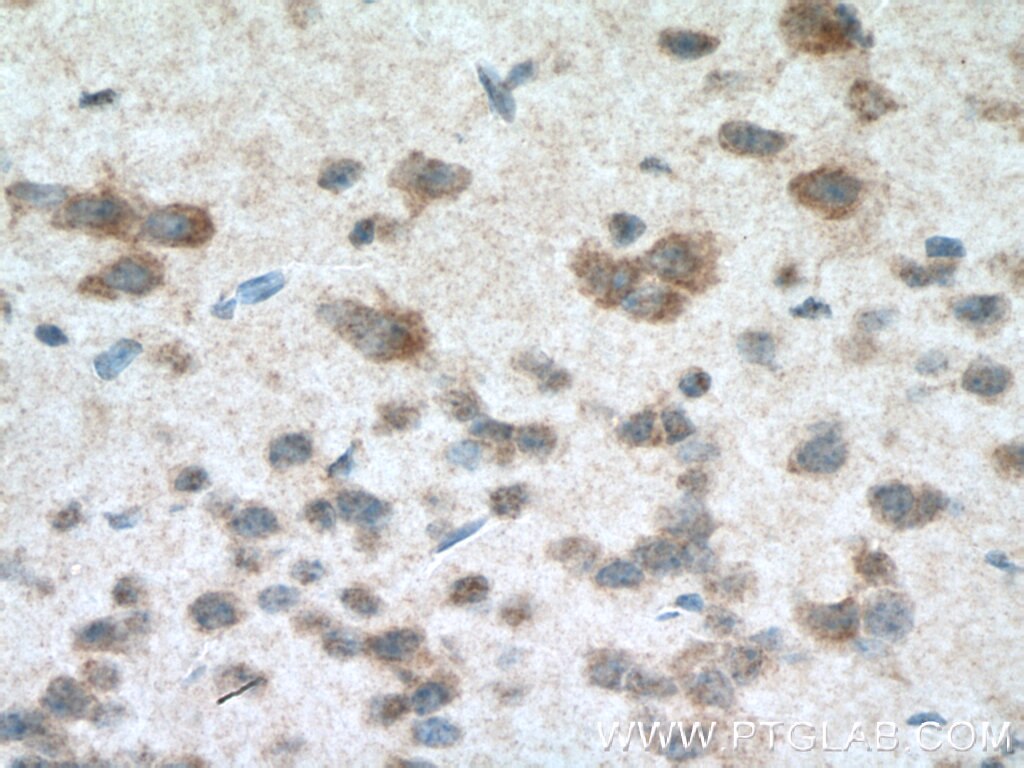 Immunohistochemistry (IHC) staining of mouse brain tissue using CHCHD2 Polyclonal antibody (19424-1-AP)