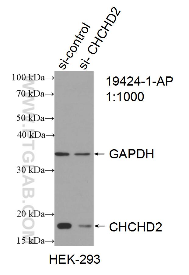 Western Blot (WB) analysis of HEK-293 cells using CHCHD2 Polyclonal antibody (19424-1-AP)