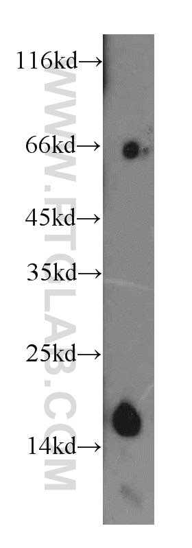 Western Blot (WB) analysis of human adrenal gland tissue using CHCHD2 Polyclonal antibody (19424-1-AP)
