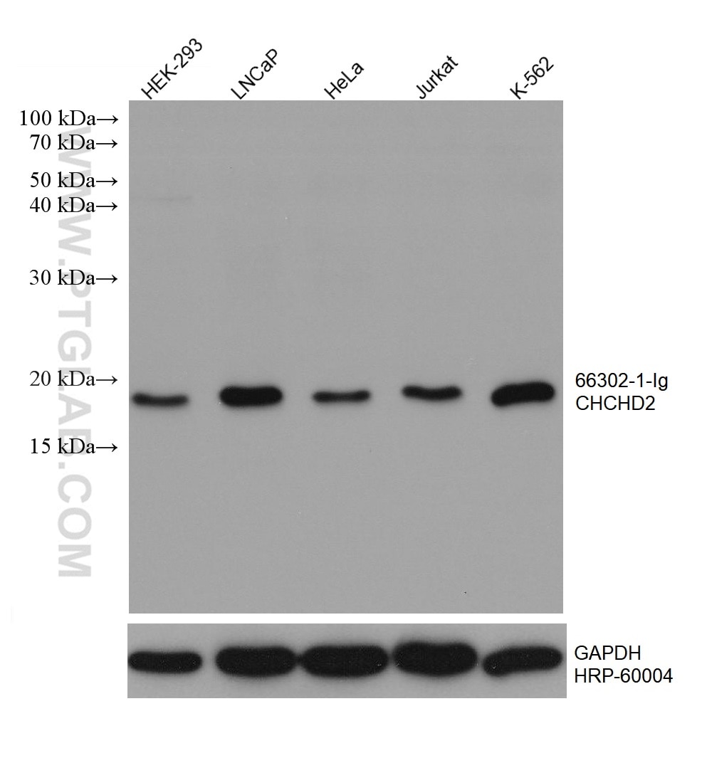 WB analysis using 66302-1-Ig