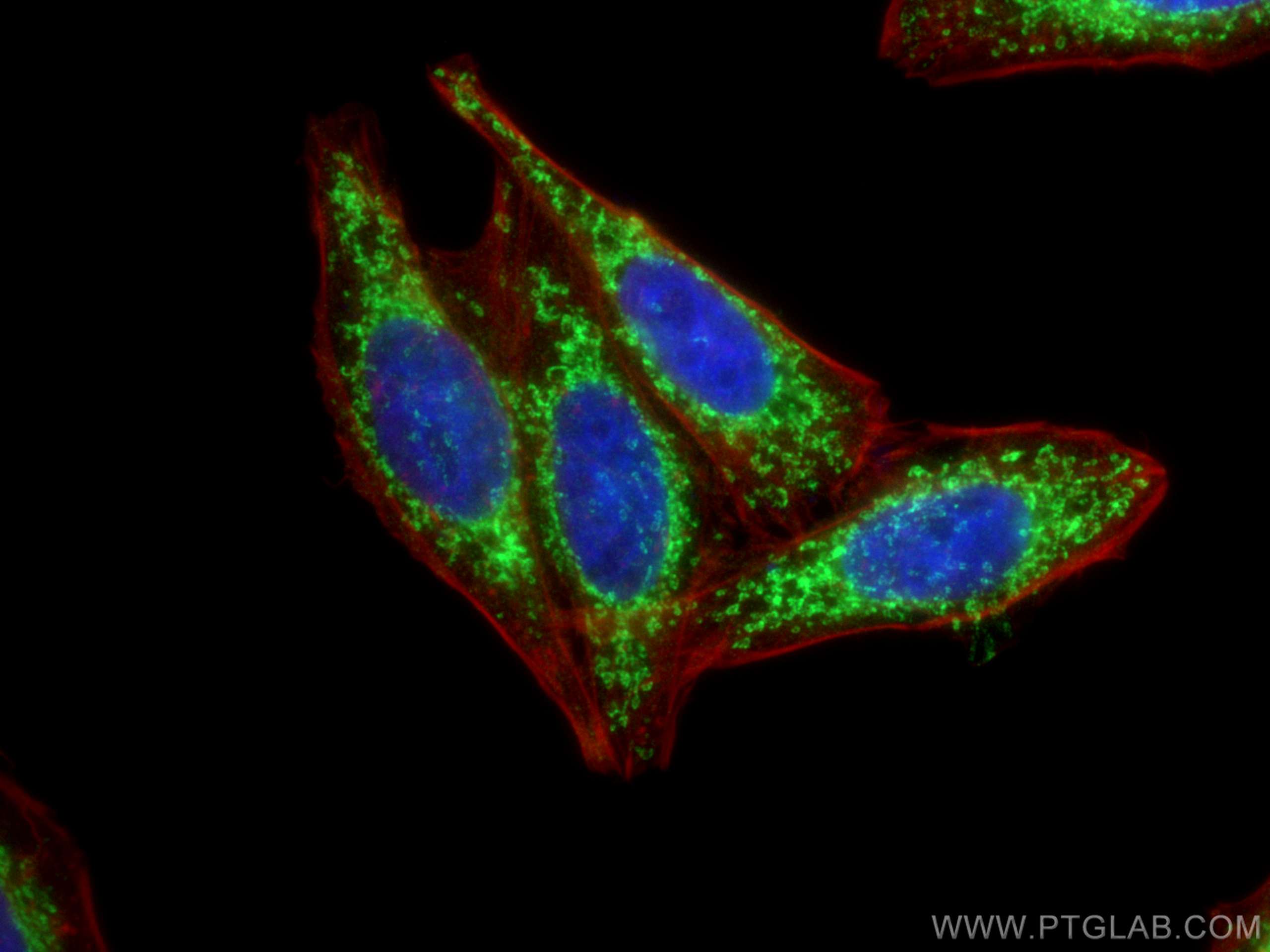 Immunofluorescence (IF) / fluorescent staining of HepG2 cells using CHCHD3 Polyclonal antibody (25625-1-AP)