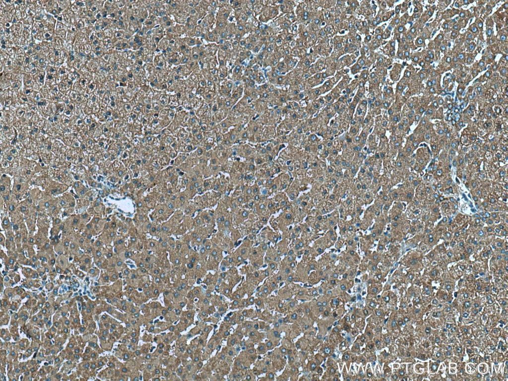 Immunohistochemistry (IHC) staining of human liver tissue using CHCHD3 Polyclonal antibody (25625-1-AP)