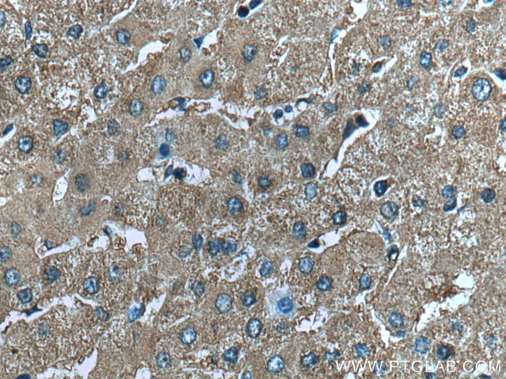 Immunohistochemistry (IHC) staining of human liver tissue using CHCHD3 Polyclonal antibody (25625-1-AP)